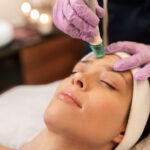 Higiene facial con Peeling Químico